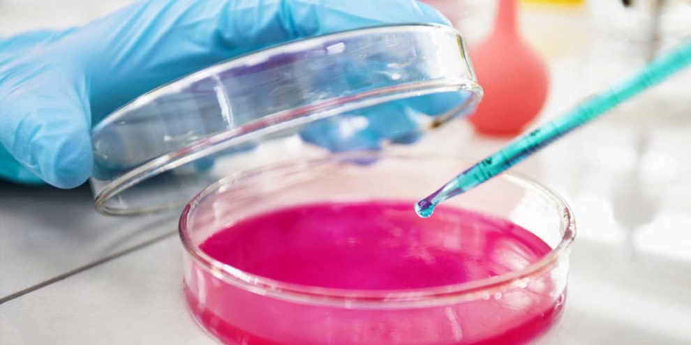 How to Choose CO2 Incubator