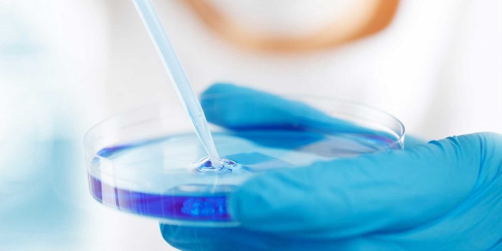 Related Equipment For Cell Culture (3): CO2 Incubator